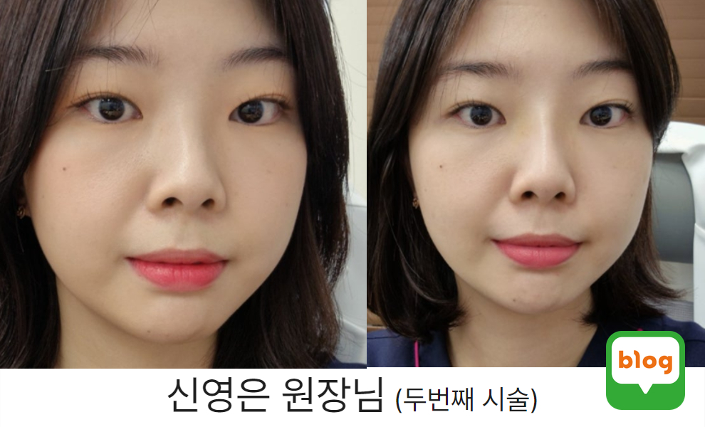 신원장님 2차 레이디코 후기