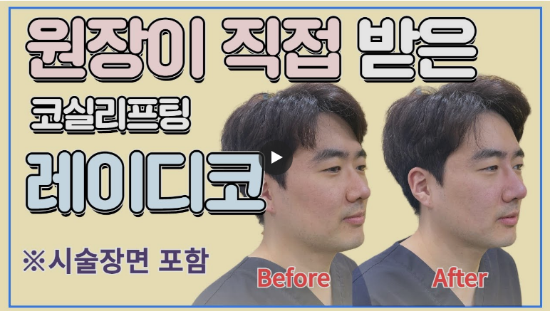 원장이 직접 받은 코실리프팅 레이디코 — Before / After 비교, 시술 장면 포함